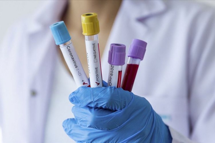 İngiltere'de toplu koronavir&uuml;s testleri yapılacak