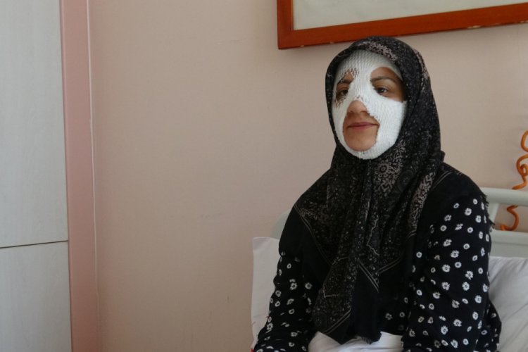 D&uuml;d&uuml;kl&uuml; tencere y&uuml;z&uuml;n&uuml; bu hale getirdi
