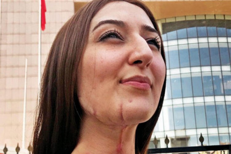 Rabia Kacmaz Dan Avukatin Savunmasina Tepki Kadin Olacaksin Bir De Bursada Bugun Bursa Bursa Haber Bursa Haberi Bursa Haberleri Bursa