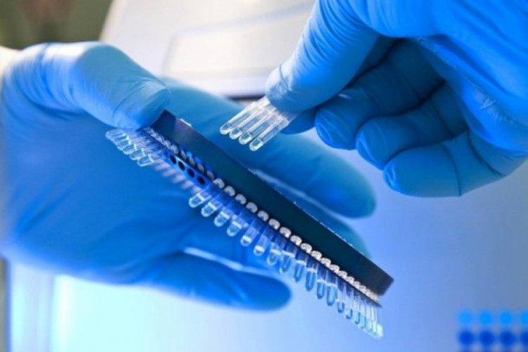 Corona vir&uuml;s&uuml; 1 saatte test eden Qiagen'e 11.5 milyar dolarlık teklif