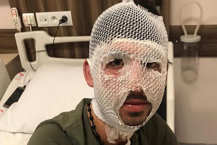 'Yunan polisi kaynar su d&ouml;kt&uuml;' iddiası