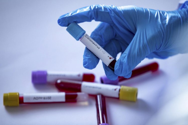 İzmir'de 'koronavir&uuml;s' soruşturması