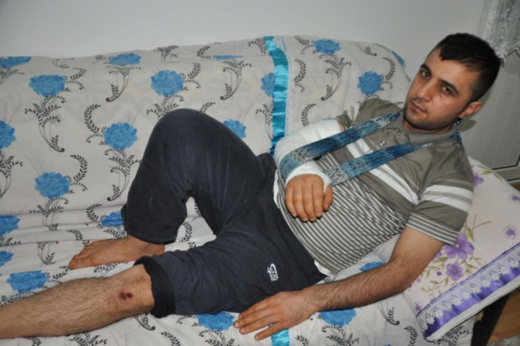 Sokak k&ouml;peklerinin saldırısına uğrayan engelli yaralandı