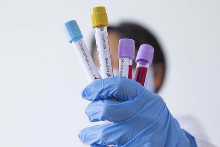 İsvi&ccedil;re'de bir g&uuml;nde 841 koronavir&uuml;s vakası