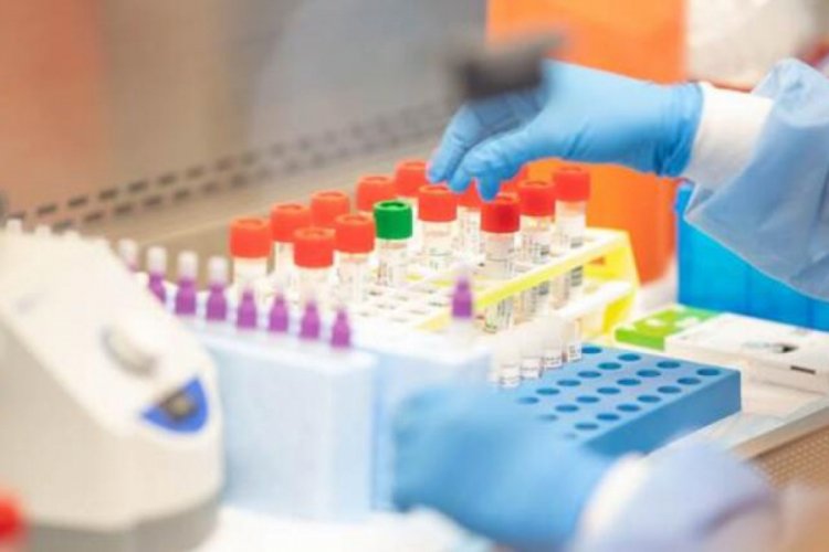 Avustralya'da yeni tip Corona Vir&uuml;sten &ouml;lenlerin sayısı 6'ya y&uuml;kseldi