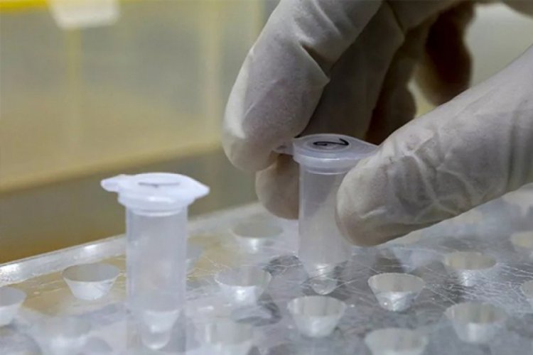 &Ccedil;in'den T&uuml;rkiye'ye 2 milyon yeni test kiti!