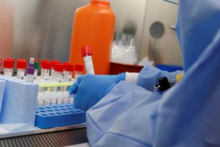 İsrail'de Corona Vir&uuml;s vaka sayısı 1238'e &ccedil;ıktı
