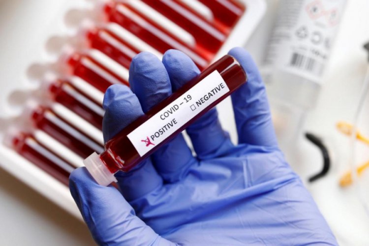 T&uuml;rkiye'den Kolombiya'ya 26 bin koronavir&uuml;s tanı testi