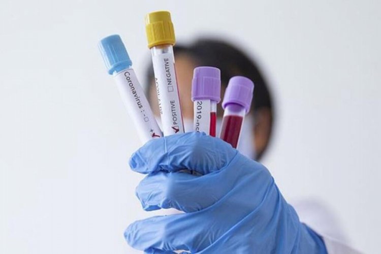 İki aile hekiminin koronavir&uuml;s test sonucu pozitif &ccedil;ıktı!