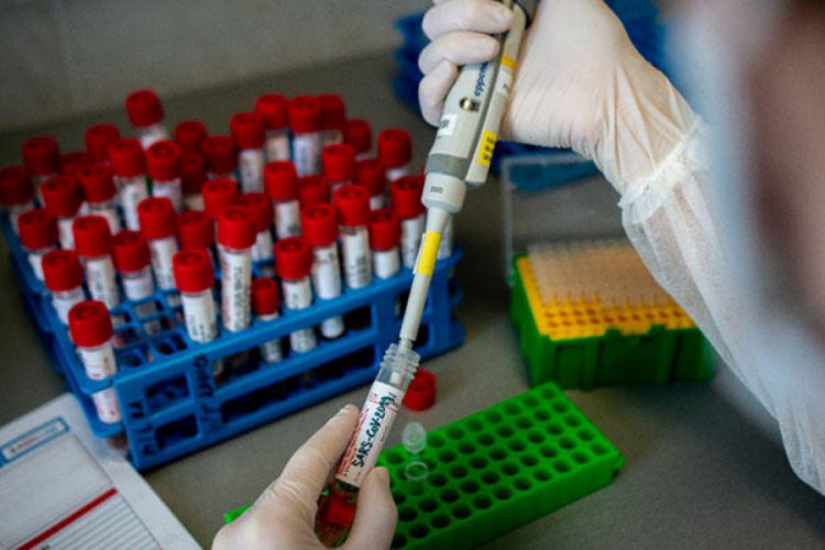 &quot;Evde test uygulamasına geçilebilir&quot; Güncel Haberler