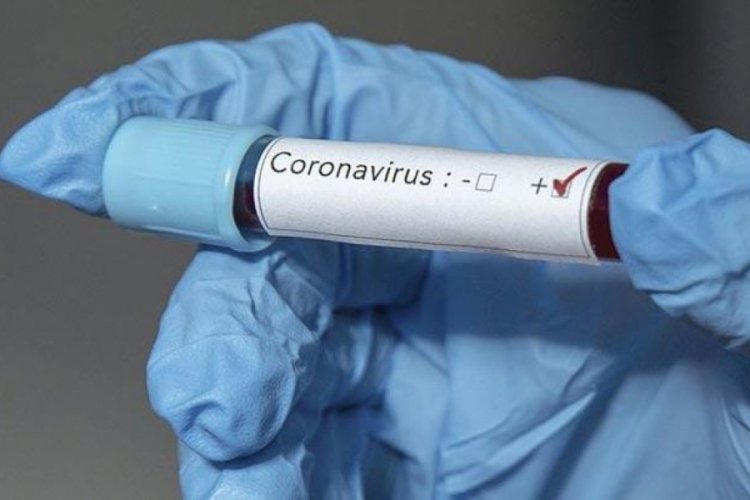 BM: Suriye'de 10 kişide corona vir&uuml;s g&ouml;r&uuml;ld&uuml;