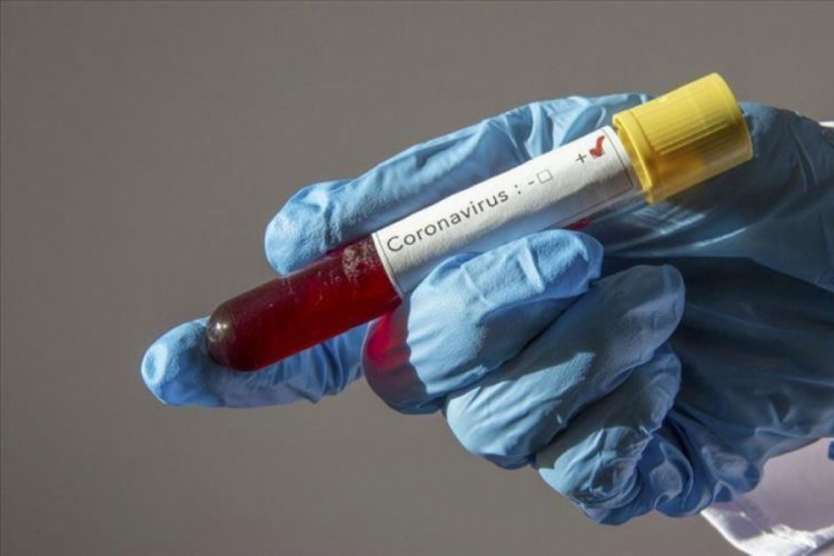 Meclis hastanesi doktorunun koronavirüs testi sonucu belli oldu