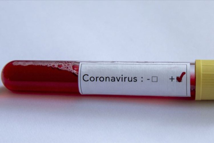 Kongo Halk Cumhuriyeti'nde Kovid-19'dan ilk can kayıpları