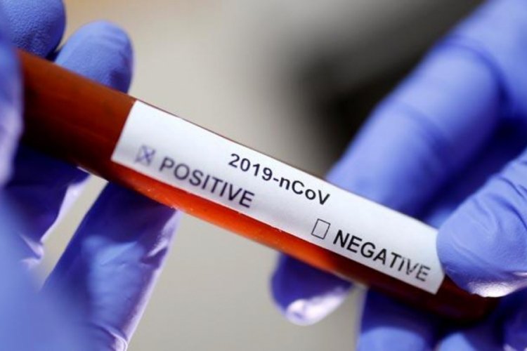 "Afrika'da Kovid-19 aşı denemesi yapılmalı" diyen Fransız doktorlara tepki