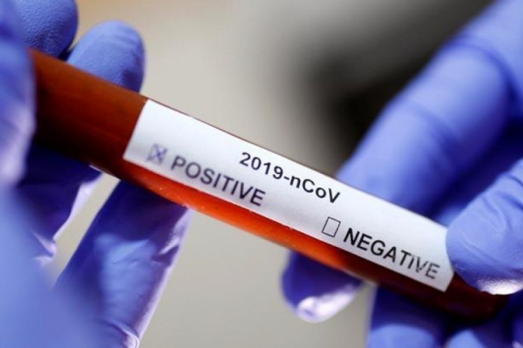 "Gazze Şeridi'nde korona vir&uuml;s&uuml; test kitleri t&uuml;kendi"