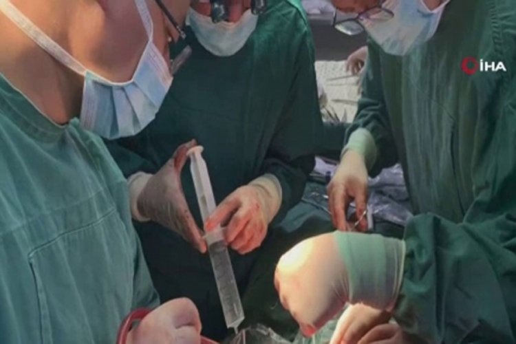 Gen&ccedil; kızın karnından 18 santimetrelik t&uuml;m&ouml;r &ccedil;ıktı