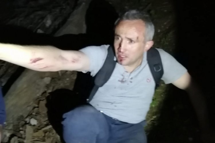Mantar toplamak isterken ayağını kırdı