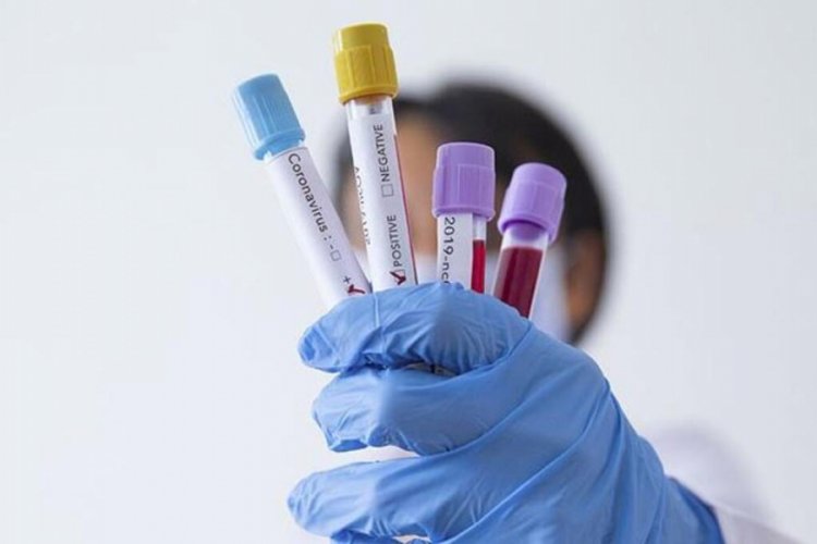 Türkiye'deki son vaka ve ölüm sayısı belli oldu