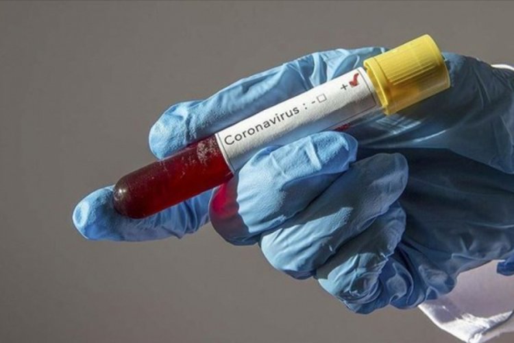 Corona vir&uuml;s bildirime esas bulaşıcı hastalık listesine alındı