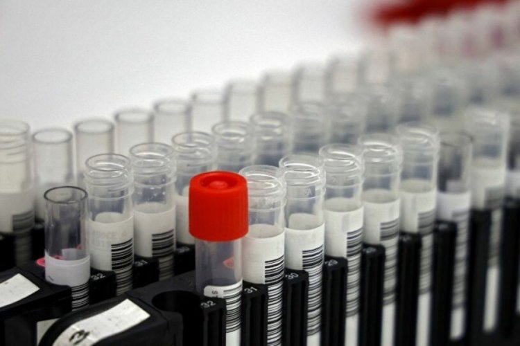 "Pandemilerin tekrarlanmaması i&ccedil;in insanlar hayatta kalma stratejisini değiştirmeli"