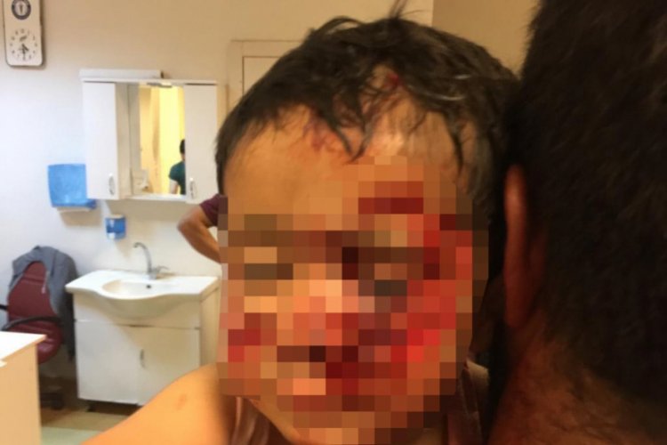 K&ouml;pek saldırısına uğrayan k&uuml;&ccedil;&uuml;k Davut, kurtarılamadı