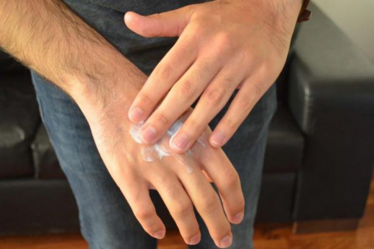 'Sık kullanılan dezenfektan &uuml;r&uuml;nleri el egzamasına yol a&ccedil;abilir'
