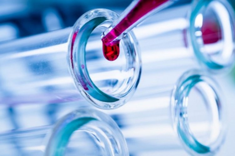 20 dakikada sonu&ccedil; verecek test geliştirildi