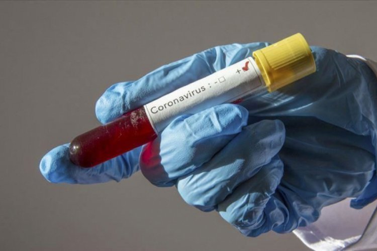 Cezaevinde Kovid-19 testi pozitif &ccedil;ıkan 55 kişi hastaneye sevk edildi