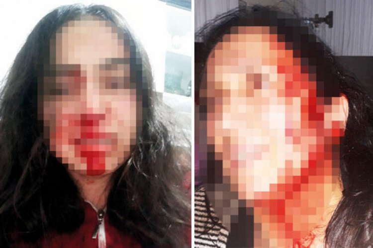 Anne-kız isyan etti: Bizi &ouml;ld&uuml;recek, sahip &ccedil;ıkın