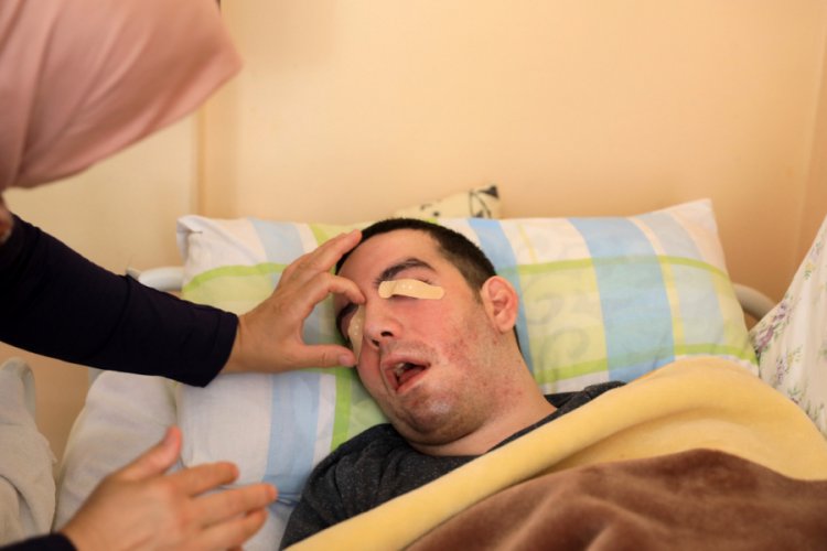 Yatalak oğlunun g&ouml;zlerini 6 yıldır yara bandıyla kapatıyor