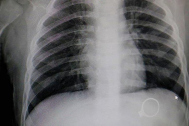 1.5 yaşındaki bebek, annesinin 3 bin liralık yüzüğünü