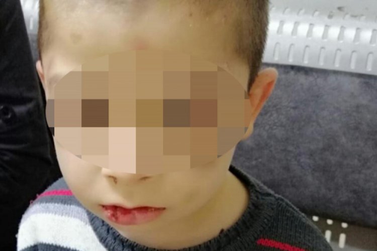 &Uuml;vey babasının işkencesi nedeniyle korumaya alındı