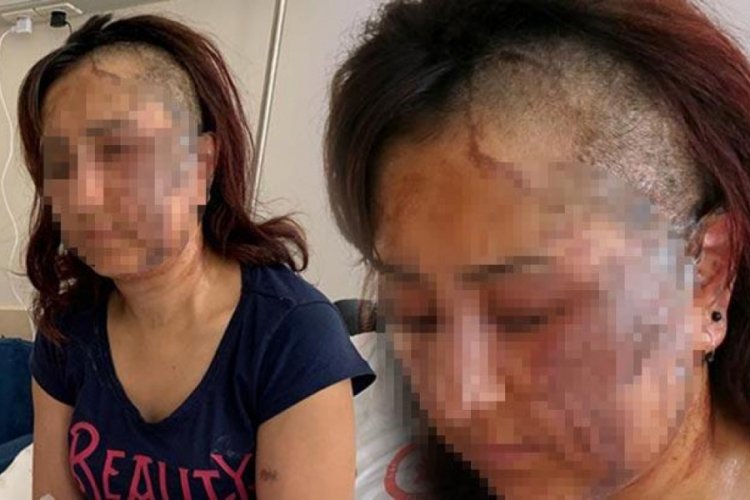 Boşanmak isteyen eşine kezzapla saldırdı!