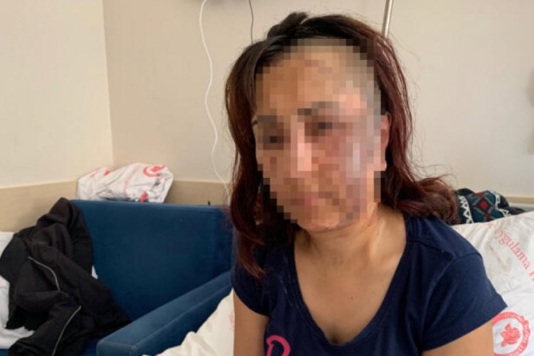 Kezzap vahşetine ilişkin Cumhuriyet Başsavcısı'ndan a&ccedil;ıklama!
