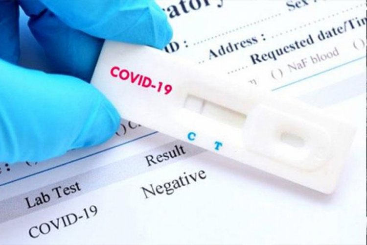 Japonya hızlı test kitlerine yeşil ışık yaktı