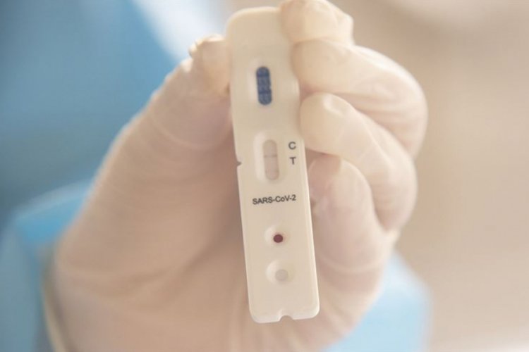 20 dakikada sonu&ccedil; veren Kovid-19 testi denenmeye başlandı