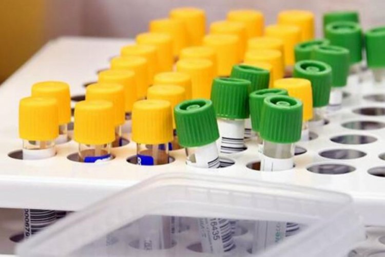D&uuml;nya genelinde koronavir&uuml;s bilan&ccedil;osu: Can kaybı 344 bin 29'a y&uuml;kseldi