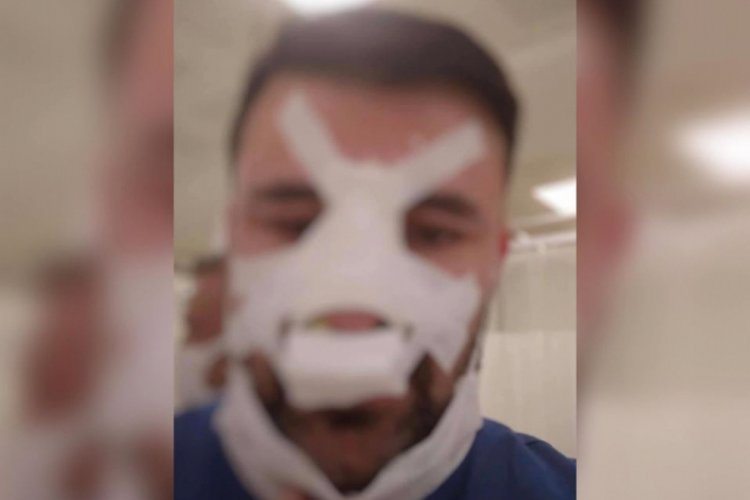 Sağlık &ccedil;alışanının burnunu kırdı, serbest kaldı