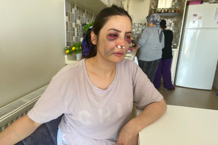 Gen&ccedil; kadın sonda kurtuldu! "10 yıldır bu adamdan kurtulmaya &ccedil;alışıyorum"