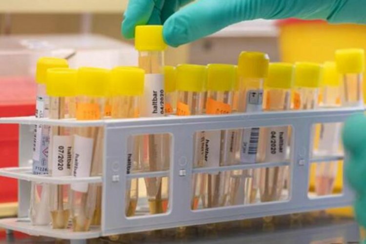 İran'da koronavir&uuml;sten son 24 saatte 70 &ouml;l&uuml;m