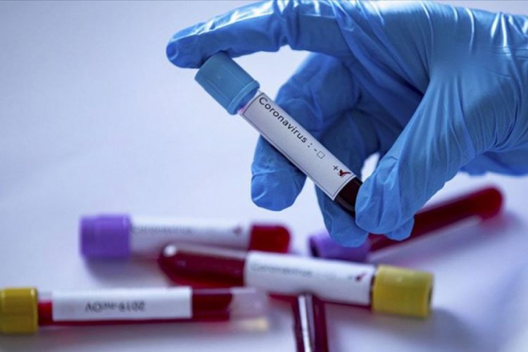 Polonya'da 5 bine yakın madenciye vir&uuml;s bulaştı