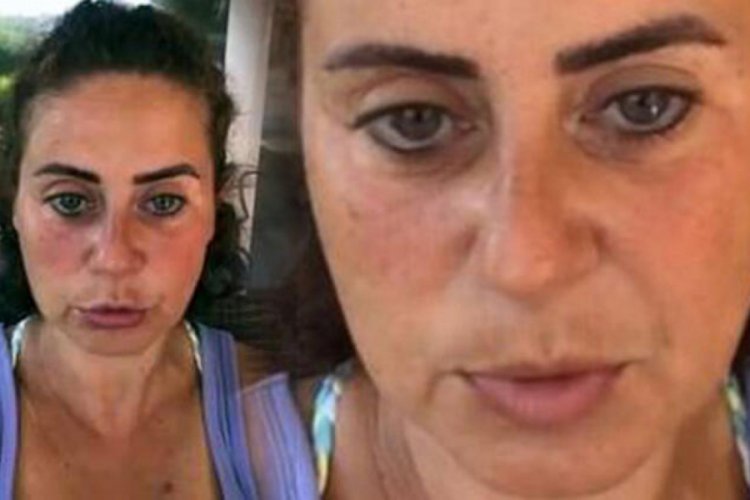 &Uuml;nl&uuml; oyuncu aynı maskeyi kullanınca enfeksiyon kaptı!