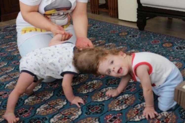 Cumhurbaşkanı Erdoğan'dan başları yapışık kardeşlerle ilgili g&uuml;zel haber