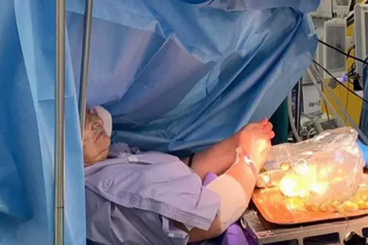 60 yaşındaki kadın, beyin ameliyatı sırasında zeytin dolması yaptı