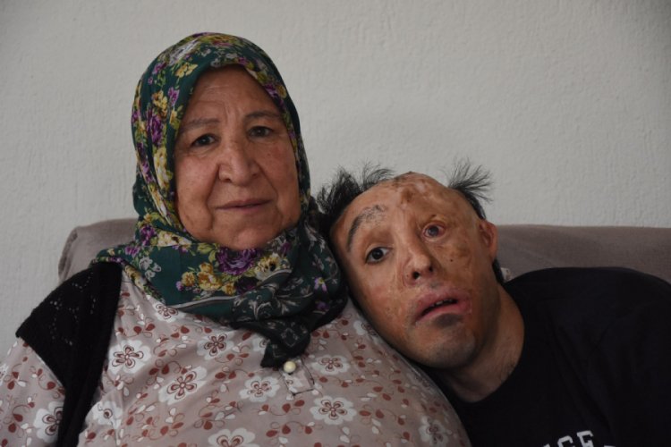 Mehmet Ali'nin ameliyatlarına koronavir&uuml;s engeli