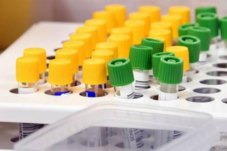 İspanya'da koronavir&uuml;sten &ouml;lenlerin sayısı 28 bin 341'e &ccedil;ıktı