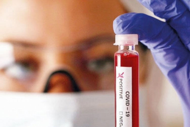 Korona vir&uuml;s testi pozitif &ccedil;ıkınca hastaneden ka&ccedil;tı