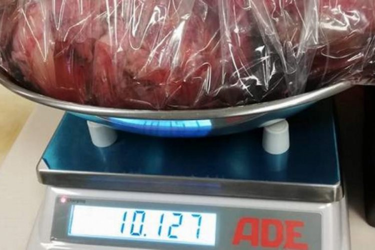 Şişkinlik i&ccedil;in gittiği hastanede hayatının şokunu yaşadı