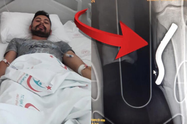 Motosikletin pedalı bacağına saplandı!