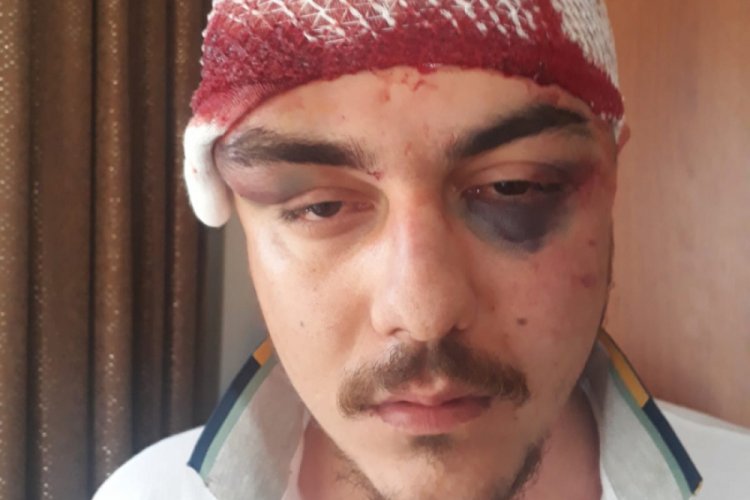 4 kişi tarafından feci şekilde d&ouml;v&uuml;ld&uuml;